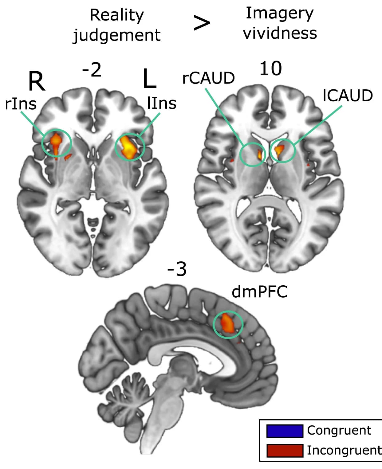 Open access visualization of Microscopy, Brain Areas, Reality Judgments, Imagery Vividness, fWE Correction
