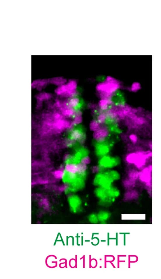 Open access visualization of Microscopy, Serotonergic Neurons, GABAergic Neurons, Raphe Nucleus, Larval Zebrafish