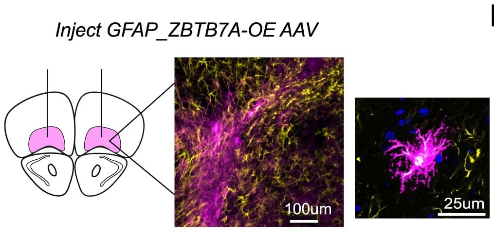 Open access visualization of Microscopy, Illustration, AAV6-GFAP-ZBTB7A-OE, OFC, Histology