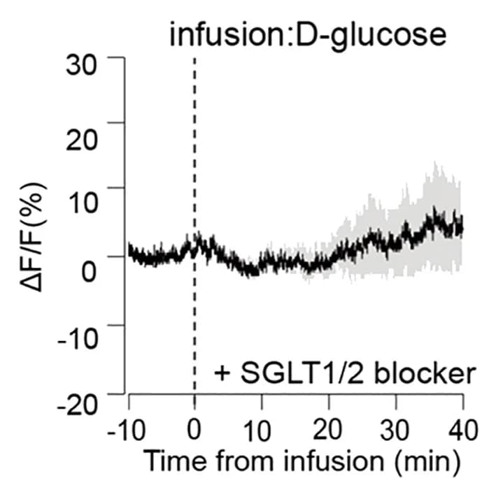 Open access visualization of Line Plot, Error Bars, PSTH Plots, D-Glucose, Phloridzin