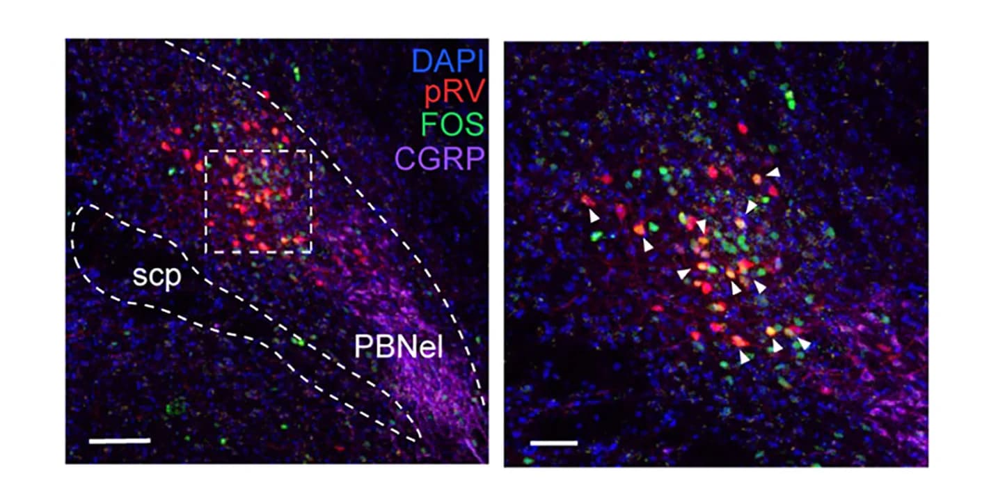 Open access visualization of Microscopy, Retrogradely Labeled Cells, Rabies Virus, PBNdl, DAPI