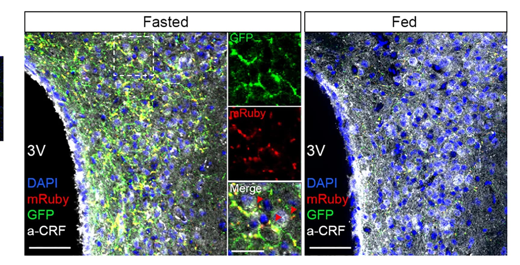 Open access visualization of Microscopy, Confocal Images, Axonal Terminals, Fasting-TRAPed PBNdl Neurons, PVN