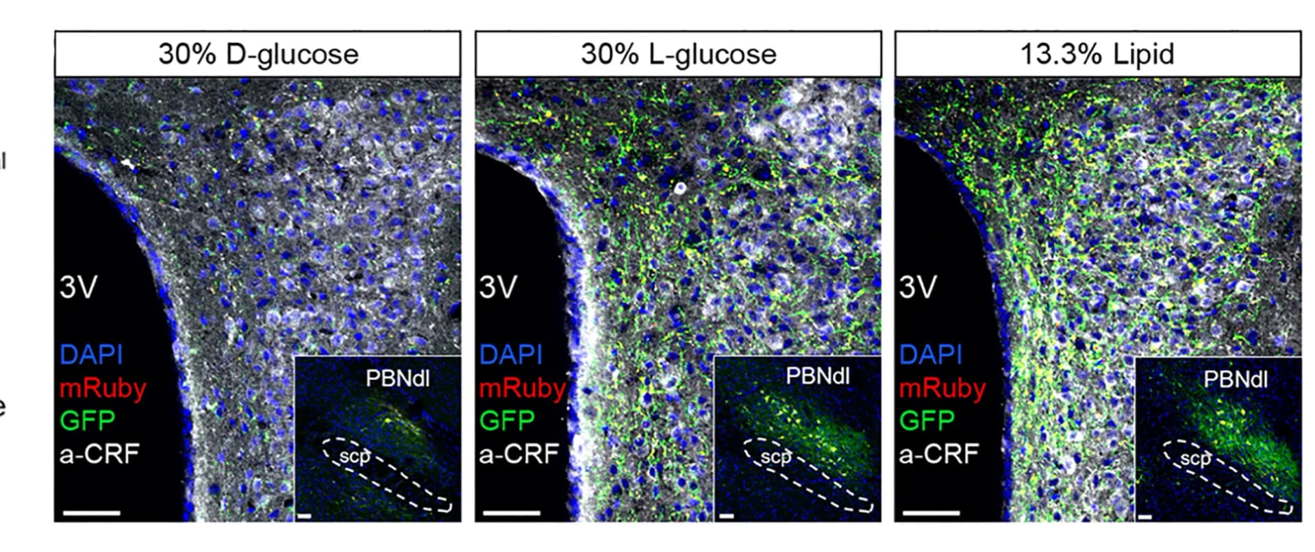 Open access visualization of Microscopy, Axonal Terminals, Fasting + ID Infusion-TRAPed PBNdl Neurons, PVN, Fasted Mice
