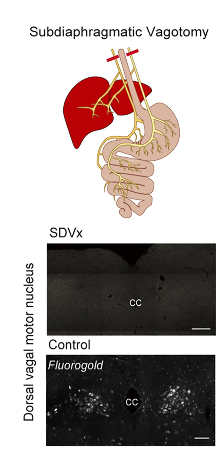 Open access visualization of Illustration, Microscopy, Surgical Procedure, Vagotomy, Histological Verification