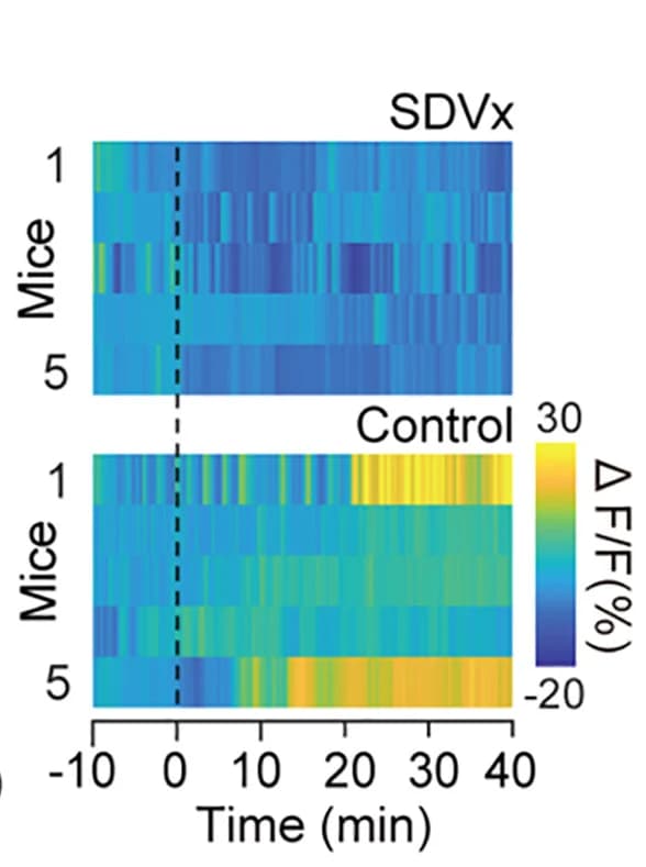 Open access visualization of Heatmap, Heatmaps, Lipid, Control Mice, Vagotomized Mice