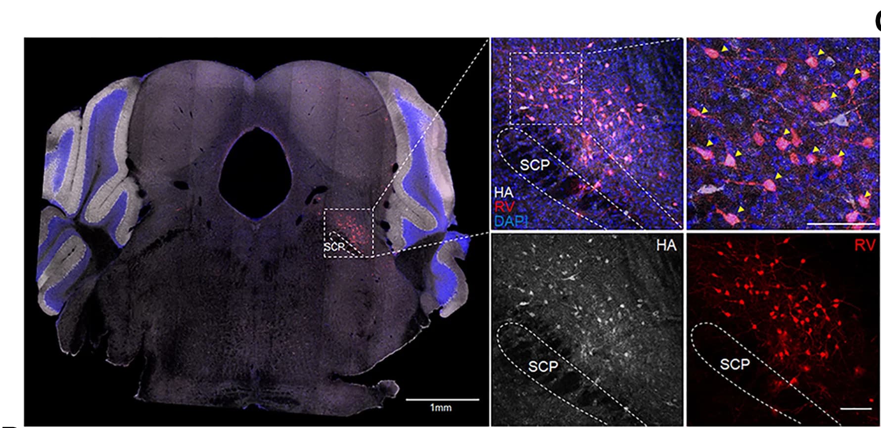 Open access visualization of Microscopy, Coronal Brain Sections, RV-labeled Neurons, PBN, Starter Cells