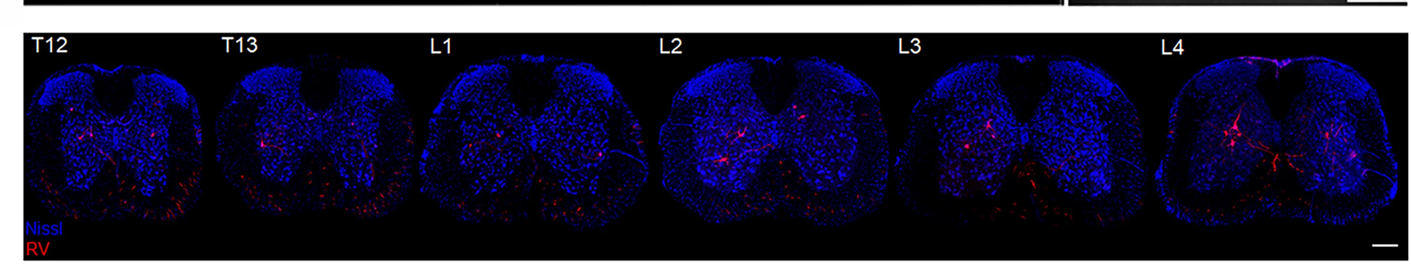 Open access visualization of Microscopy, Coronal Sections, Thoracic Spinal Cord, Lumbar Spinal Cord, RV-mCherry-labeled Neurons