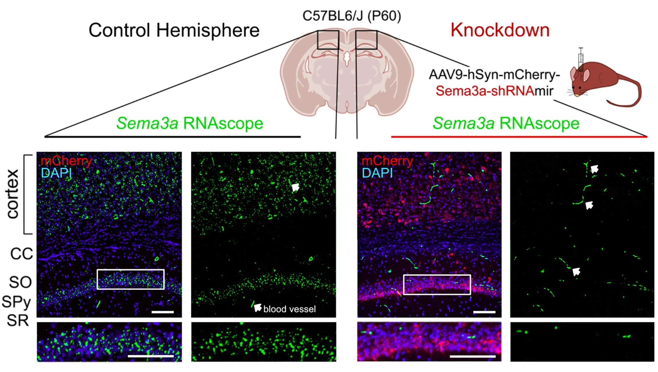 Open access visualization of Microscopy, Diagram, Sema3a RNAscope, Corpus Callosum, Stratum Oriens