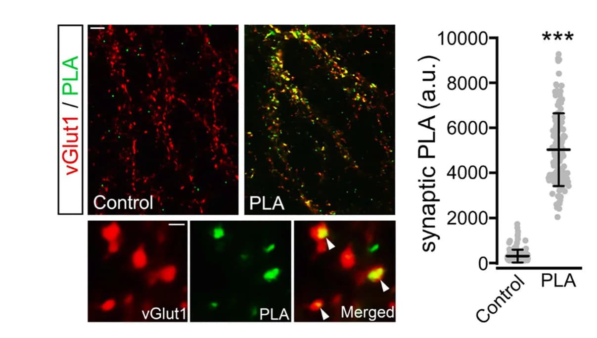 Open access visualization of Scatter Plot, Error Bars, Microscopy, PLA, PlexinA4