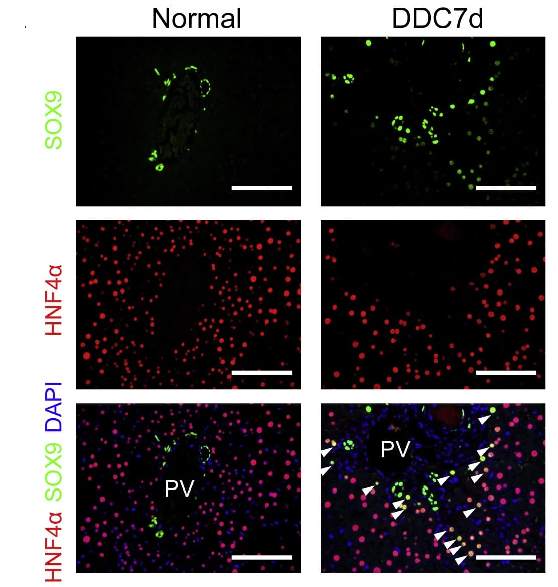 Open access visualization of Microscopy, SOX9, HNF4, Liver, DDC-injured Livers
