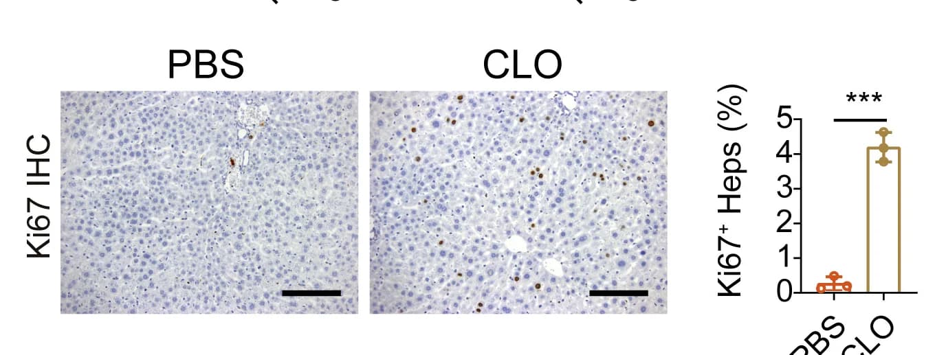 Open access visualization of Bar Plot, Microscopy, Error Bars, Immunohistochemistry, Ki67