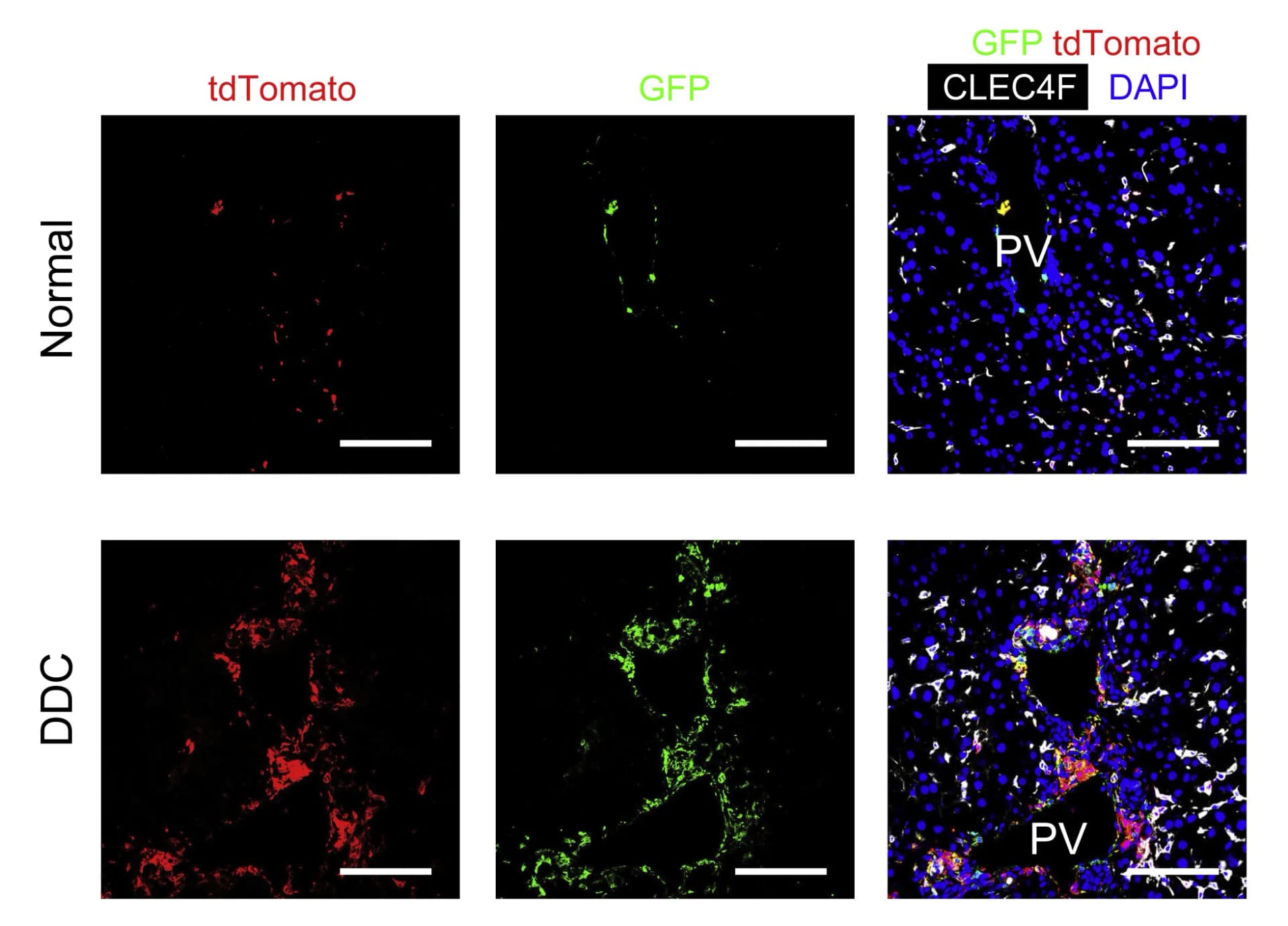 Open access visualization of Microscopy, Immunofluorescent Staining, CLEC4F