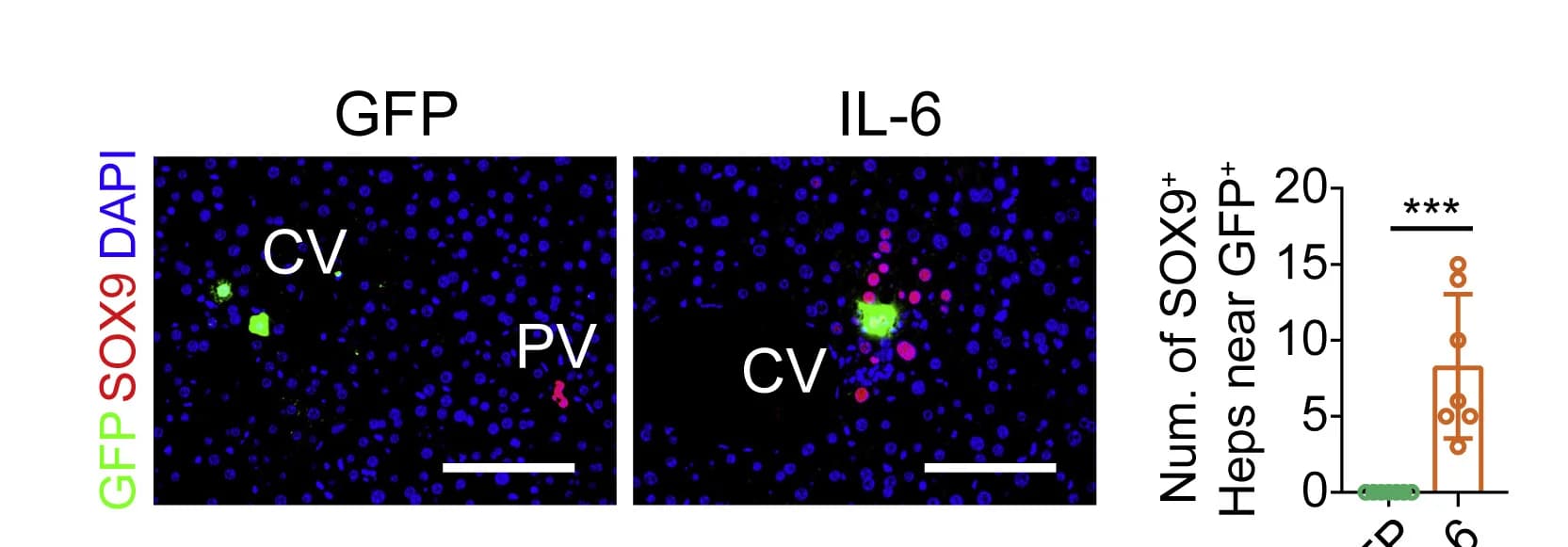 Open access visualization of Microscopy, Co-staining, SOX9, GFP, Livers