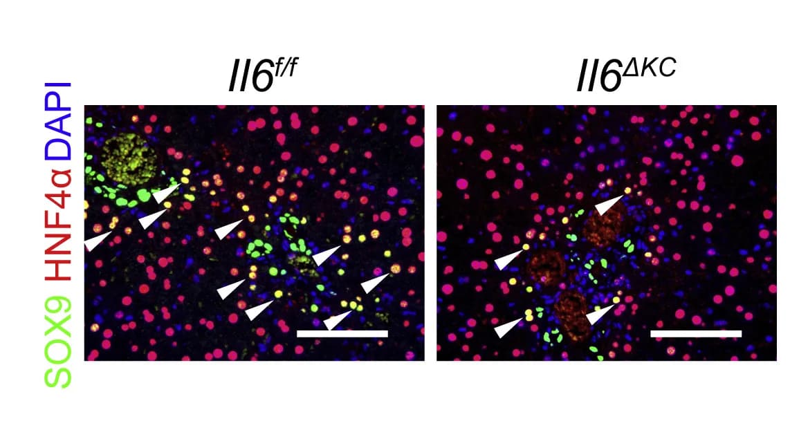 Open access visualization of Microscopy, Co-staining, SOX9, HNF4α, Il6f/f mice