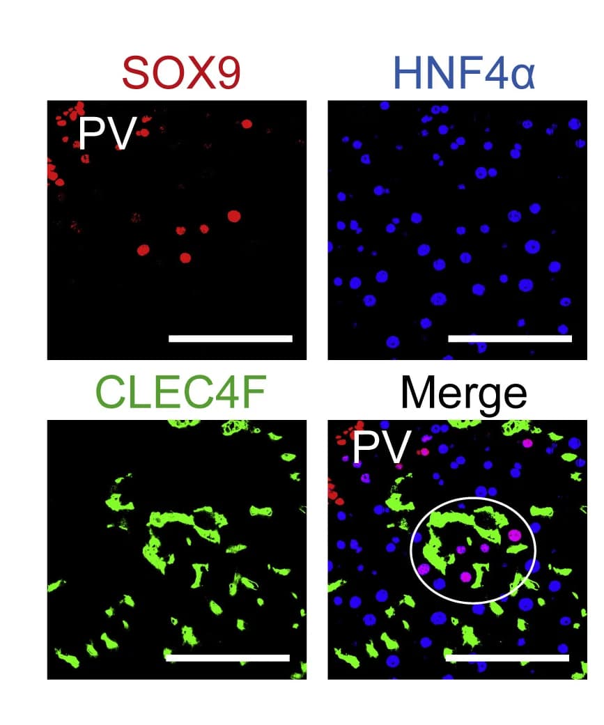 Open access visualization of Microscopy, Co-staining, SOX9, HNF4α, CLEC4F