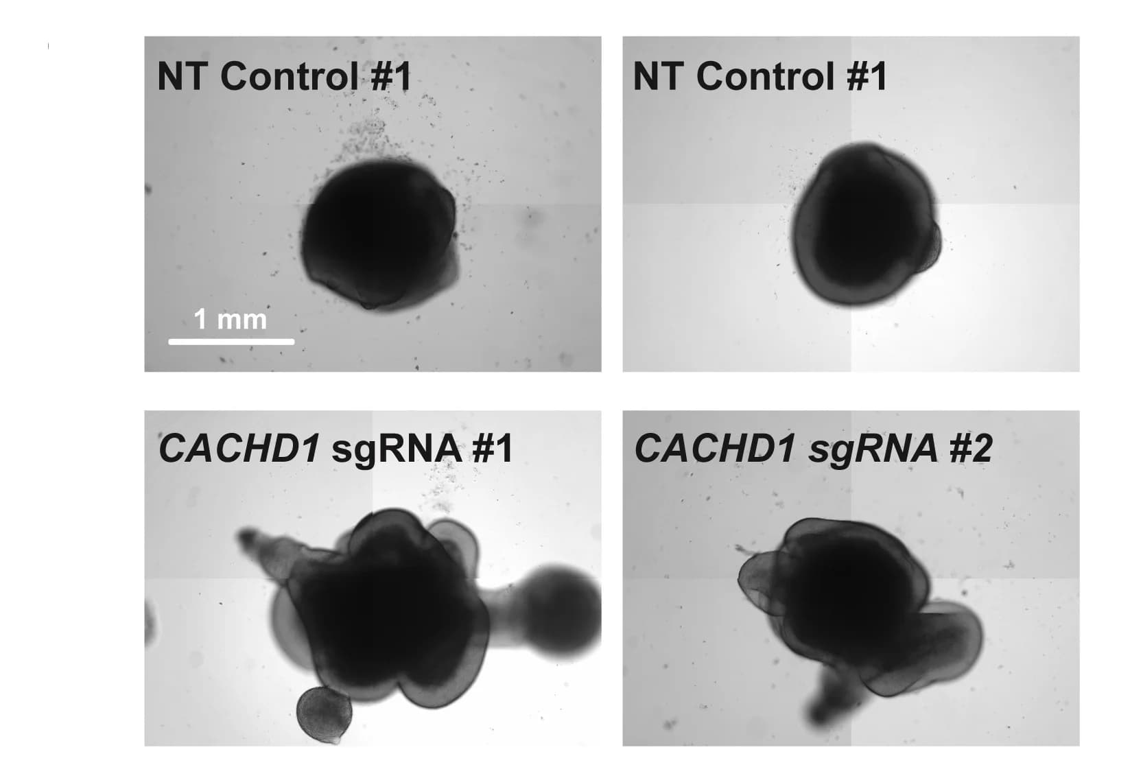 Open access visualization of Microscopy, Photo, Brightfield Images, Cerebral Organoids