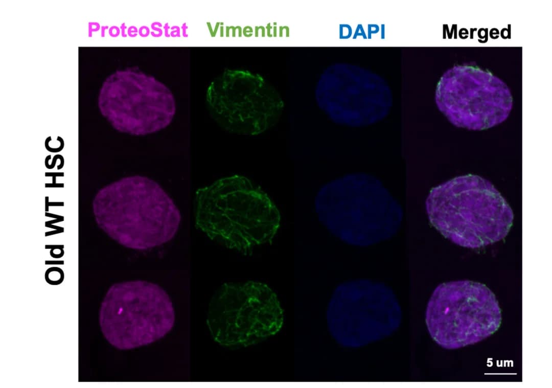 Open access visualization of Microscopy, Aggresomes, Old Mice, Wild-Type, HSCs