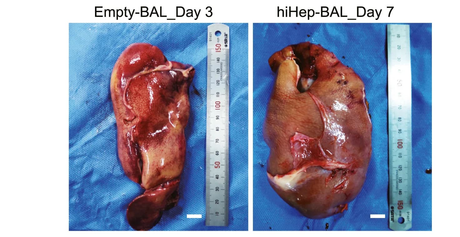 Open access visualization of Photo, Macroscopic Analysis, Liver Remnant, Empty-BAL-Treated Pigs, hiHep-BAL-Treated Pigs