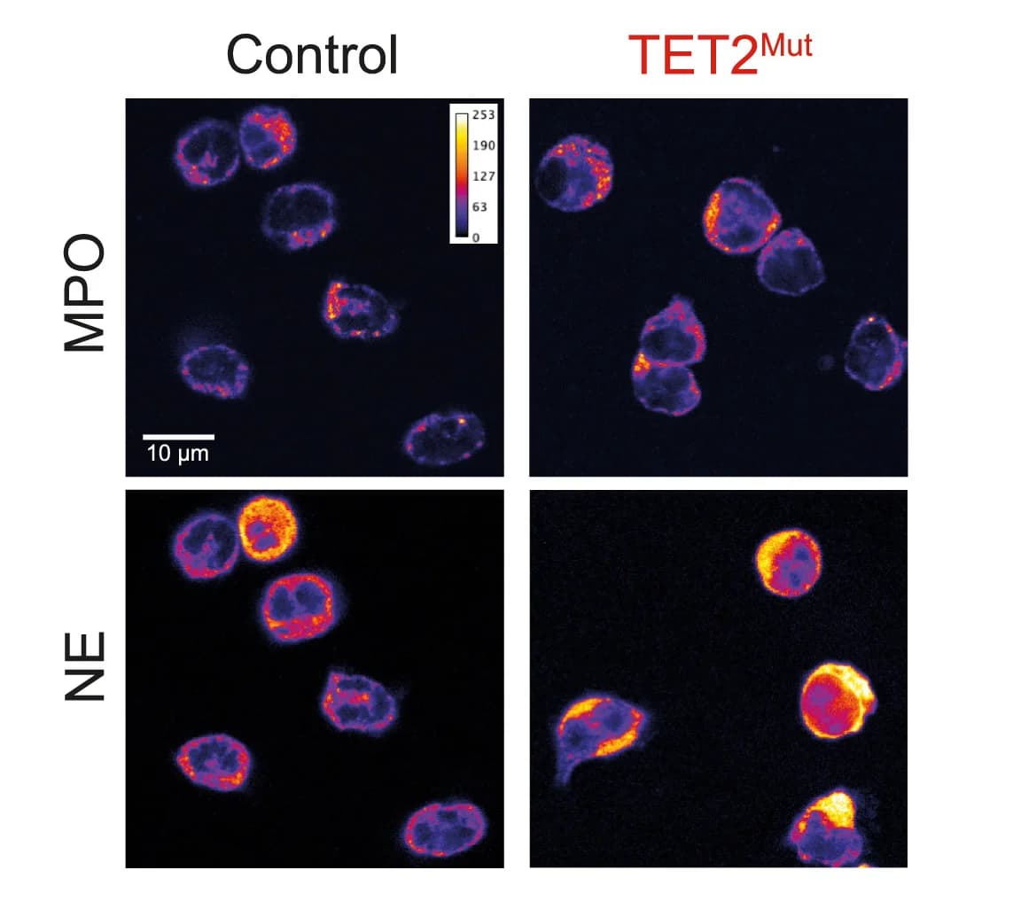 Open access visualization of Microscopy, Immunocytochemistry, MPO, Neutrophil Elastase, Neutrophils