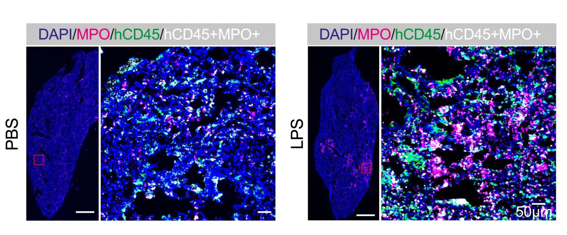 Open access visualization of Microscopy, Immunohistochemistry, Lung Section, Mouse Model, hHSPCs