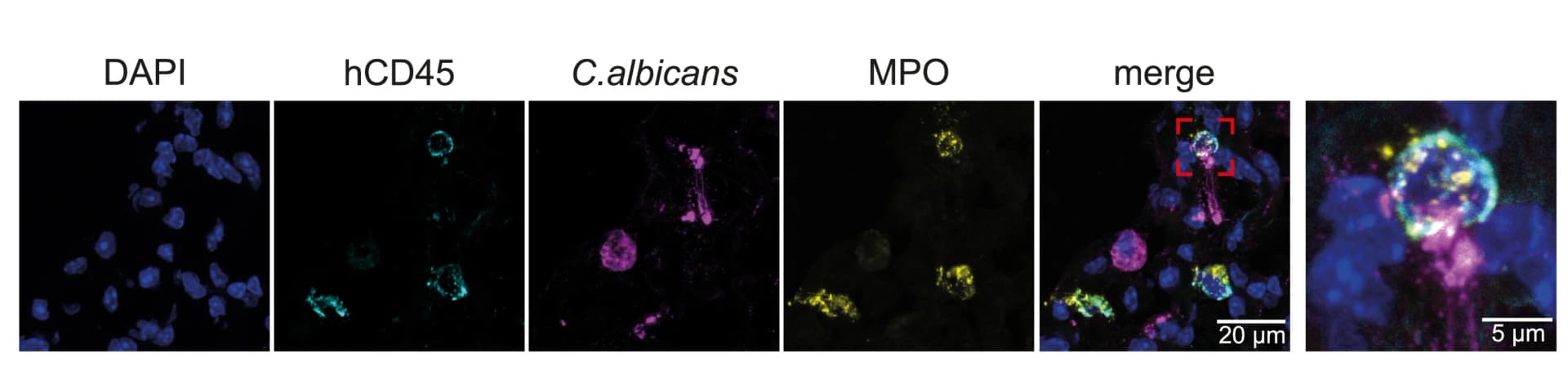 Open access visualization of Microscopy, Confocal Immunohistochemistry, Lung Section, Mouse Model, C. albicans