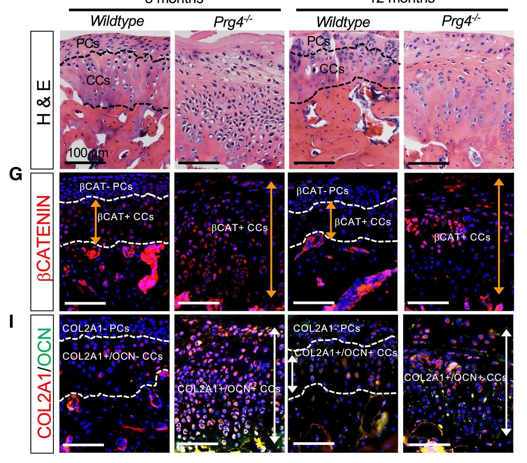 Open access visualization of Microscopy, H&E Staining, Wild-Type Mice, Prg4−/− Mice