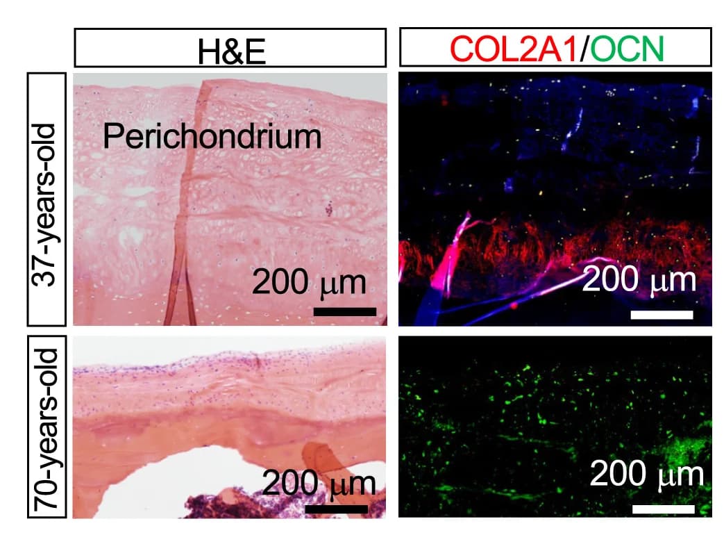 Open access visualization of Microscopy, H&E, Immunohistochemistry, Type II Collage, Osteocalcin