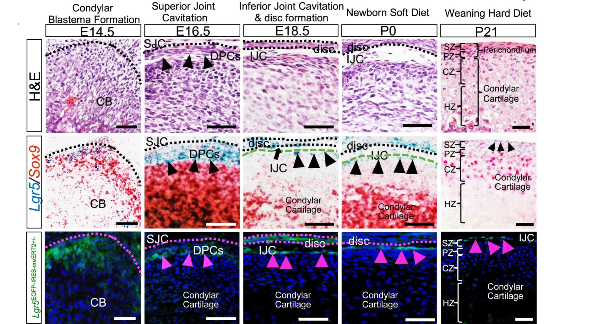Open access visualization of Microscopy, H&E Images, Mouse Jaw Joint, Developmental Stages, In Situ Hybridization
