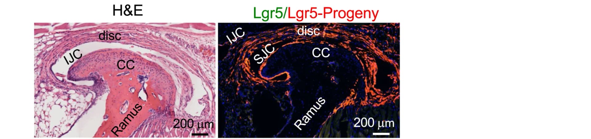 Open access visualization of Microscopy, Fluorescent Imaging, Lineage Tracing, Mandibular Condylar Cartilage, Inferior Joint Cavity