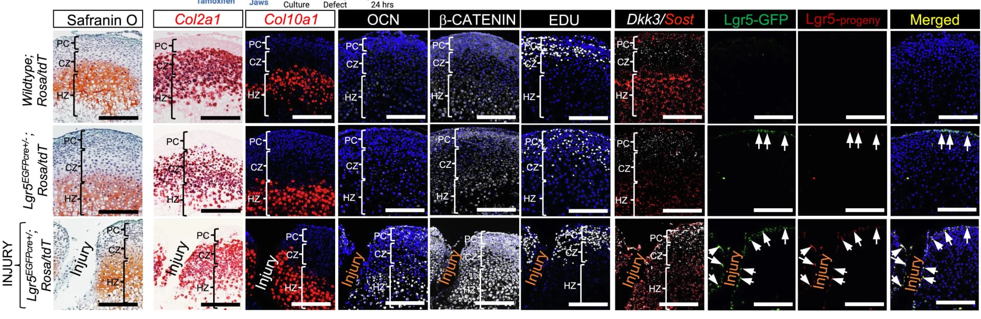 Open access visualization of Microscopy, Safranin O staining, In situ hybridization, Immunohistochemistry, Osteocalcin