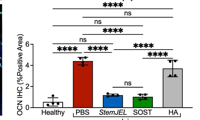 Open access visualization of Bar Plot, Error Bars, OCN Immunostaining Area, Mean, Statistical Analysis