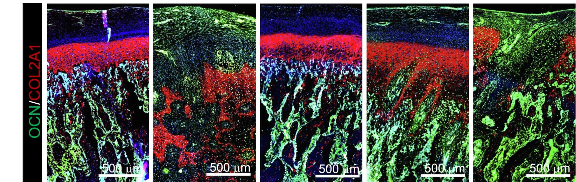 Open access visualization of Microscopy, Immunohistochemistry, Osteocalcin, Type II Collagen, Mini-Pig
