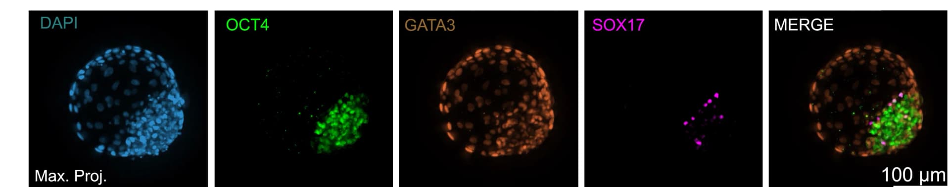 Open access visualization of Microscopy, Confocal Imaging, Blastoid, bEPI, bTE