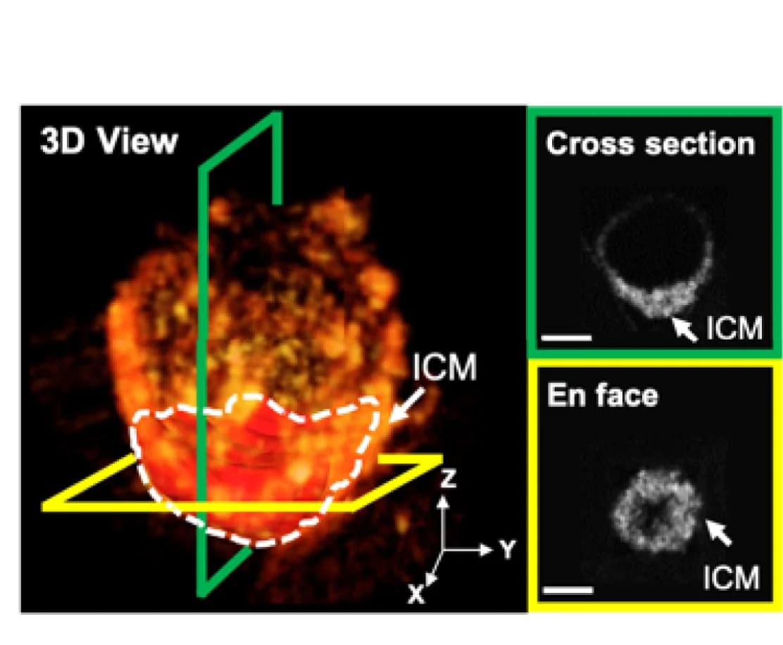 Open access visualization of Microscopy, 3D Reconstruction, OCT Image, ICM Localization, Blastoid