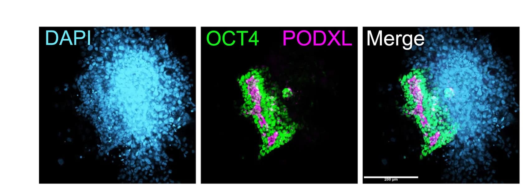 Open access visualization of Microscopy, IF Analysis, 3D-Cultured Blastoid, WIBR3 OCT4-GFP, Lumen Formation