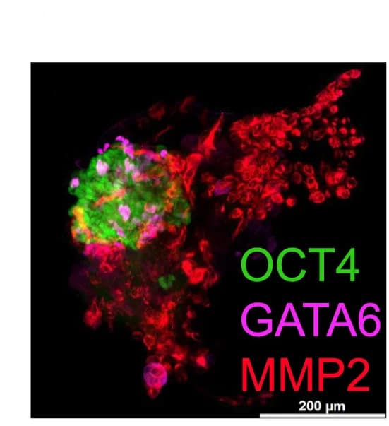 Open access visualization of Microscopy, Maximum Projection, 3D-Cultured Blastoid, WIBR3 OCT4-GFP, Protein Expression