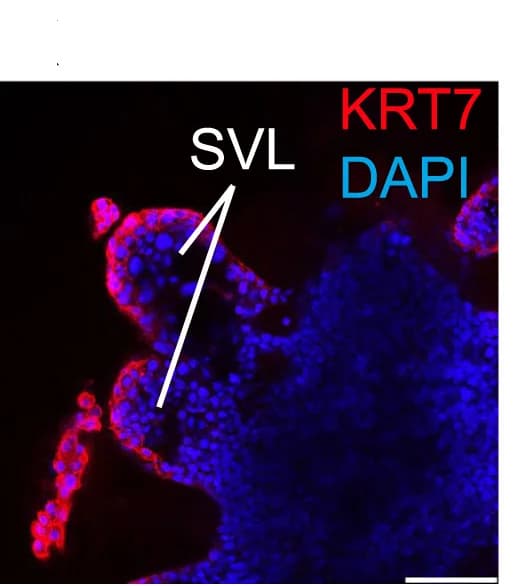 Open access visualization of Microscopy, SVLs, Embryonic Center, Trophoblasts, KRT7