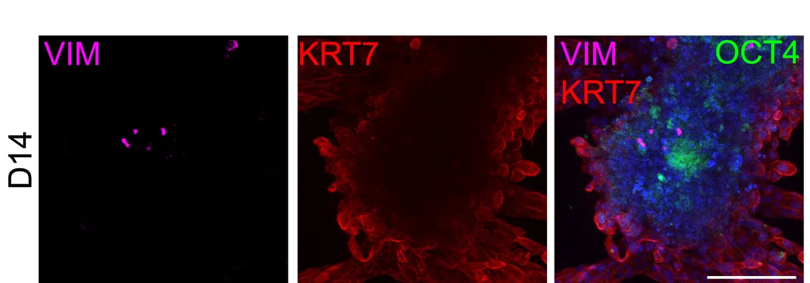 Open access visualization of Microscopy, 3D-Cultured, WIBR3 OCT4-GFP, Blastoids, VIM+ bExMes Cells