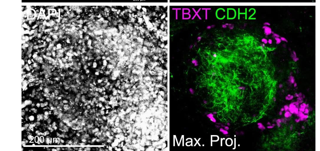 Open access visualization of Microscopy, IF Analysis, PS-like Structure, Blastoid, TBXT