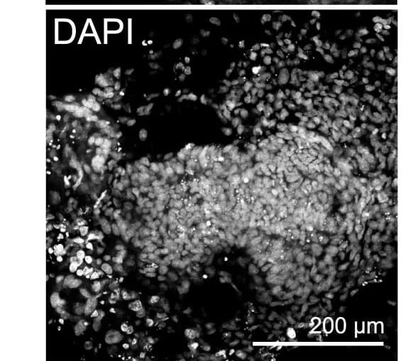 Open access visualization of Microscopy, IF Analysis, Anterior Signal Antagonists, LEFTY, CER1
