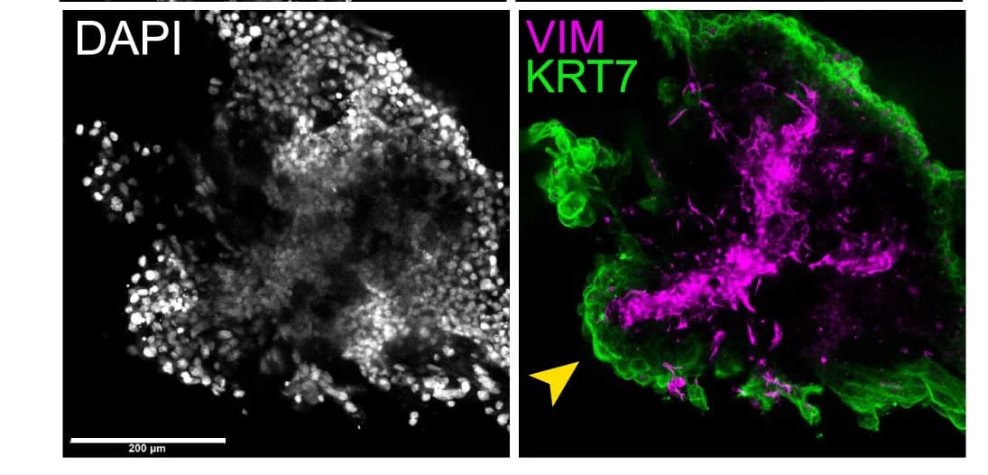 Open access visualization of Microscopy, IF Analysis, SVL Structure, Blastoid, VIM