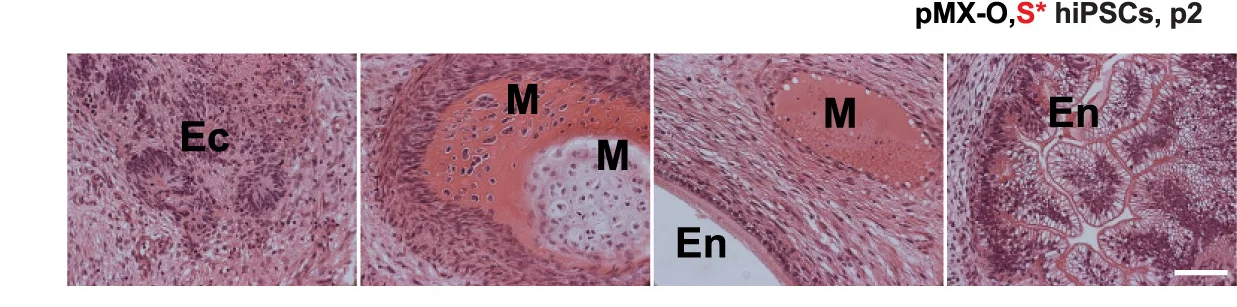 Open access visualization of Microscopy, H&E Staining, Teratoma Sections, OS hiPSCs, Ectoderm