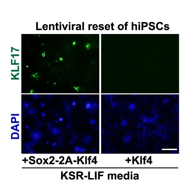 Open access visualization of Microscopy, Immunostaining, KLF17, hiPSCs, Lentiviral Vectors