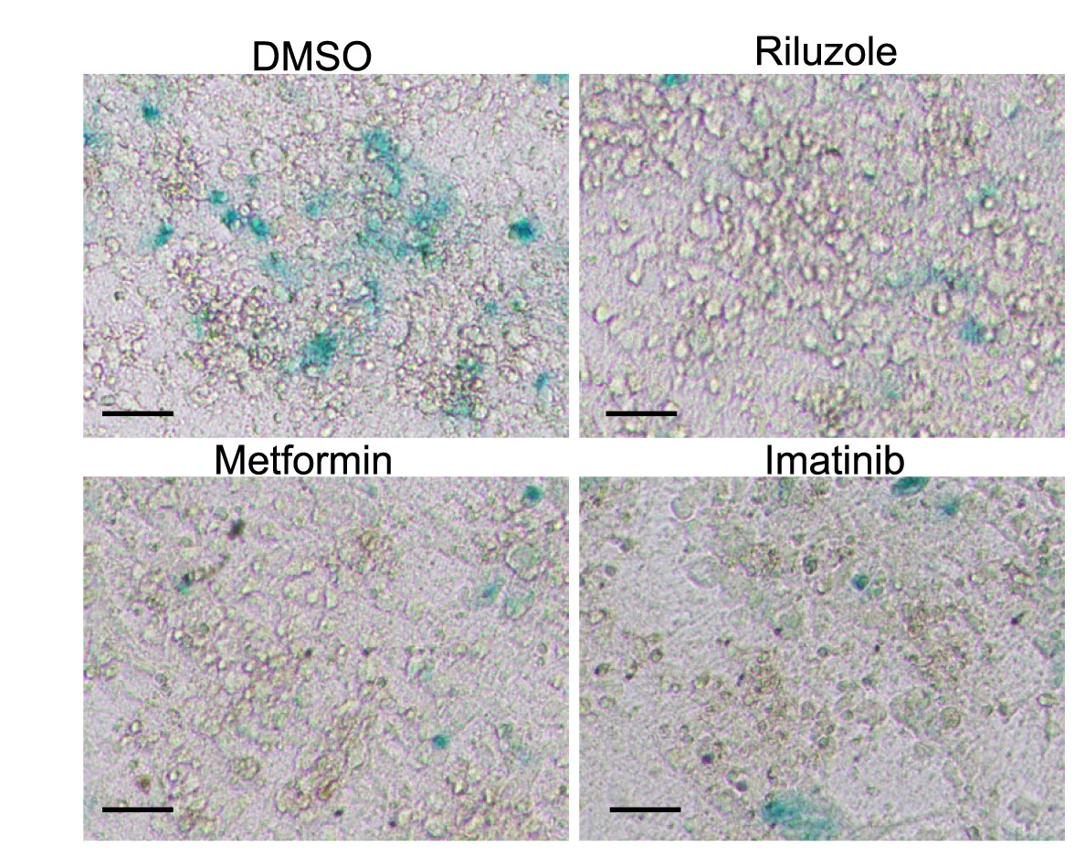 Open access visualization of Microscopy, beta-gal Staining, DMSO, Drug Candidates, NURR1:GFP H9-DA Neurons