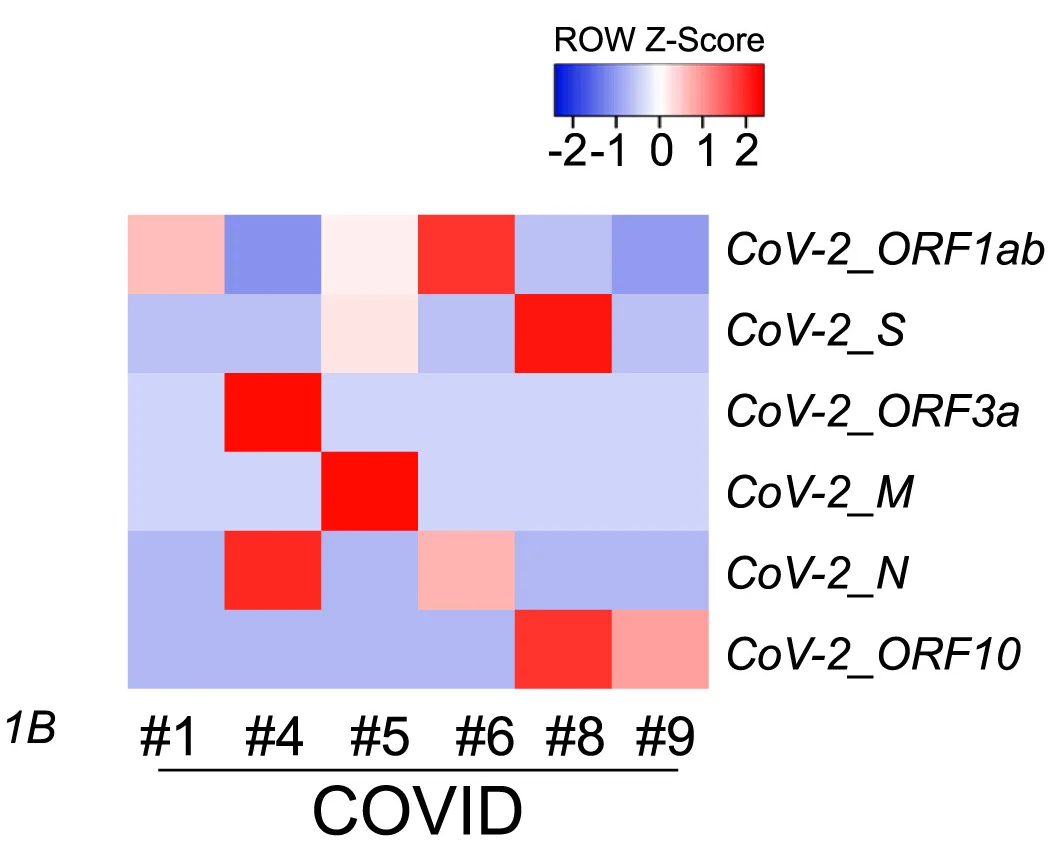 Open access visualization of Heatmap, Viral Transcripts, Substantia Nigra, COVID-19 Patients