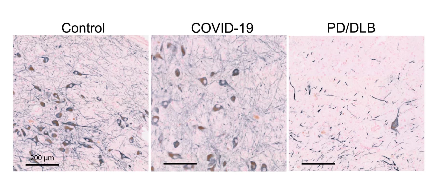 Open access visualization of Microscopy, TH-immunoreactivity, Substantia Nigra