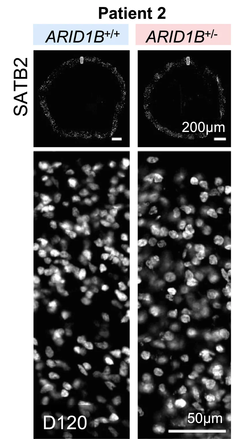 Open access visualization of Microscopy, Immunostaining, SATB2, Organoids, iPSCs
