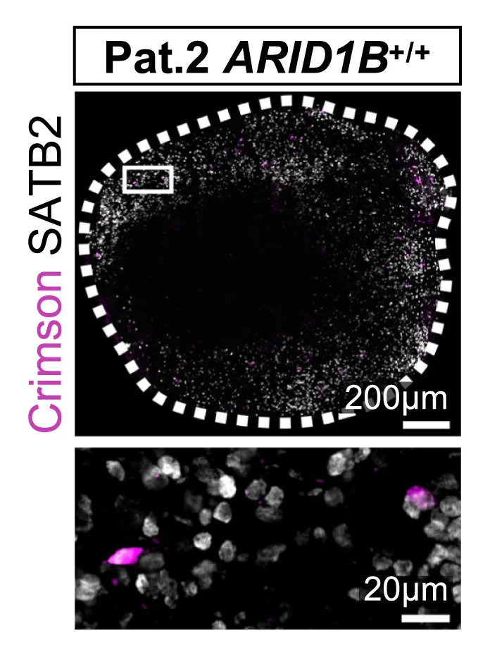Open access visualization of Microscopy, Co-immunostaining, SATB2, Crimson, Contralateral Organoid