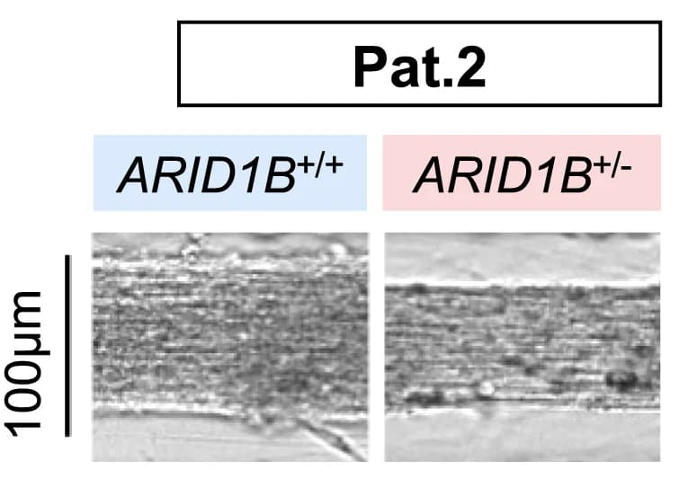 Open access visualization of Microscopy, Brightfield Imaging, Axon Tract, Pat.2 iPSC-Derived Organoids