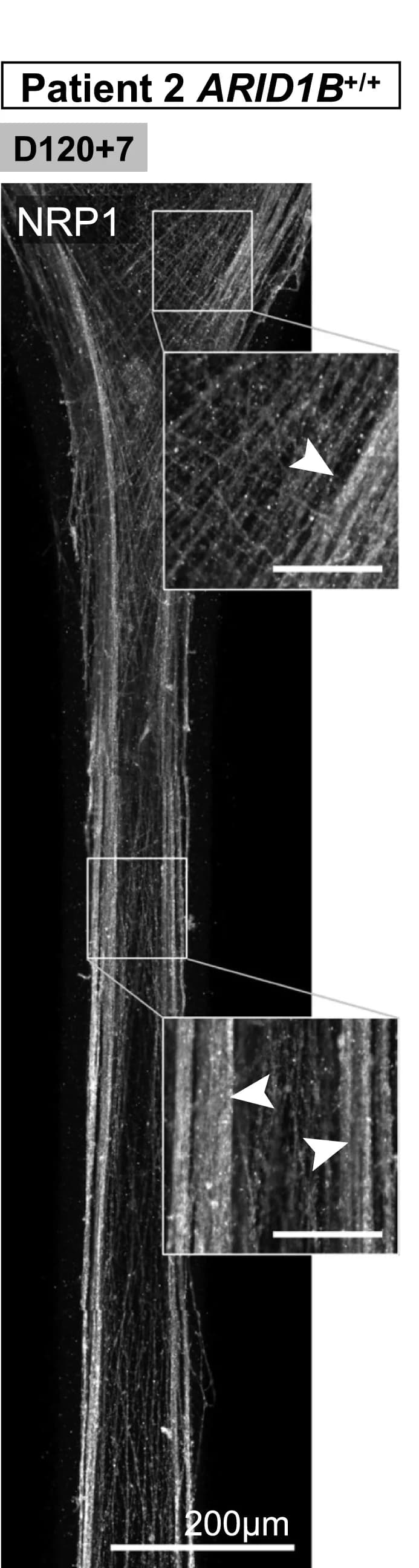 Open access visualization of Microscopy, Immunostaining, CC Marker, NRP1, Axon Bundling